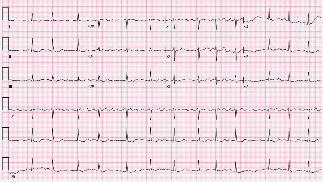 How do you describe this rhythm?
